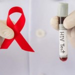 Avance científico. Ya existe la cura para el VIH
